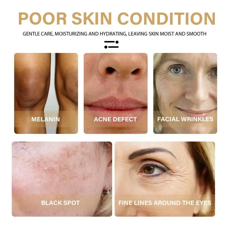 Whitening Freckle Cream
