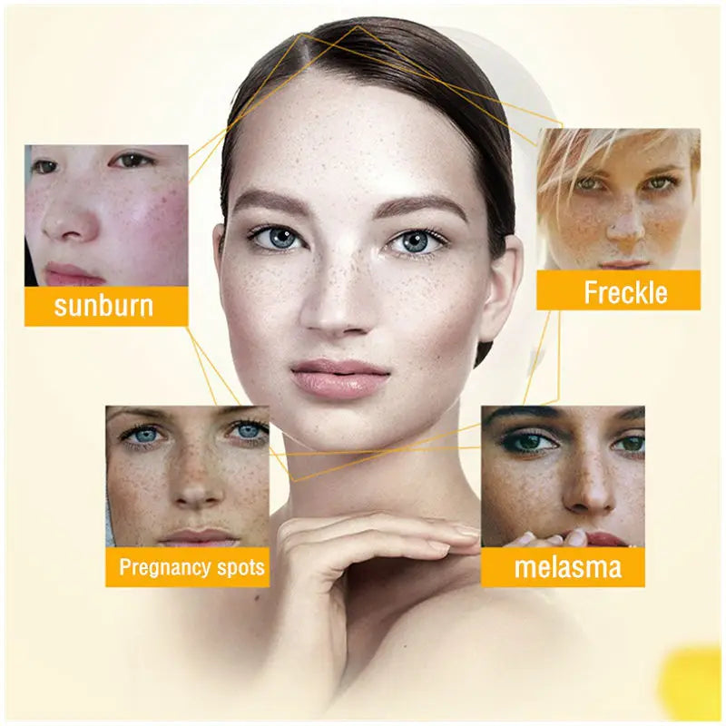 Whitening Freckle Cream